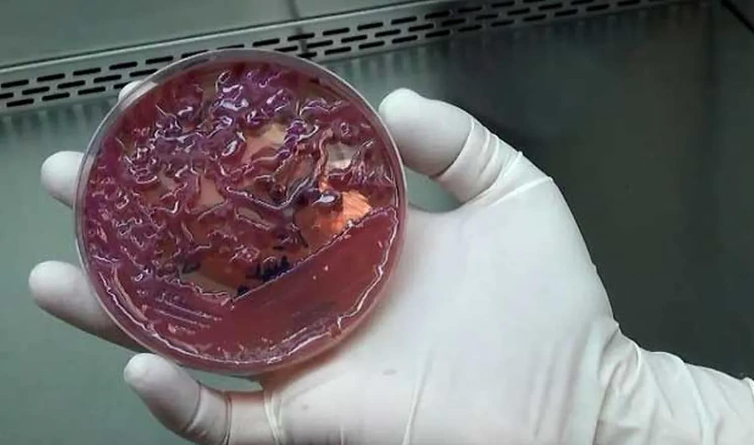 superbacteria